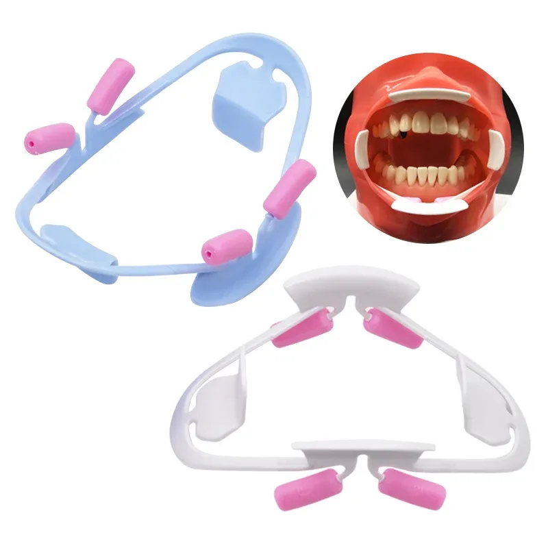 Abridor de boca Dental 3D, instrumento Dental, Retractor de labio, herramientas de dentista profesional de ortodoncia, materiales de odontología · Stone's Store